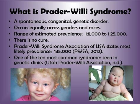 prada willies|is prader willi syndrome inherited.